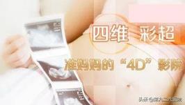 有身四维多久做(有身几周合适做四维彩超)