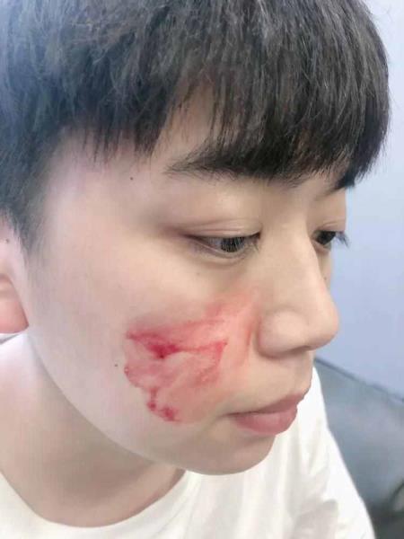 汉子毛孔粗大（汉子皮肤粗拙毛孔粗大）
