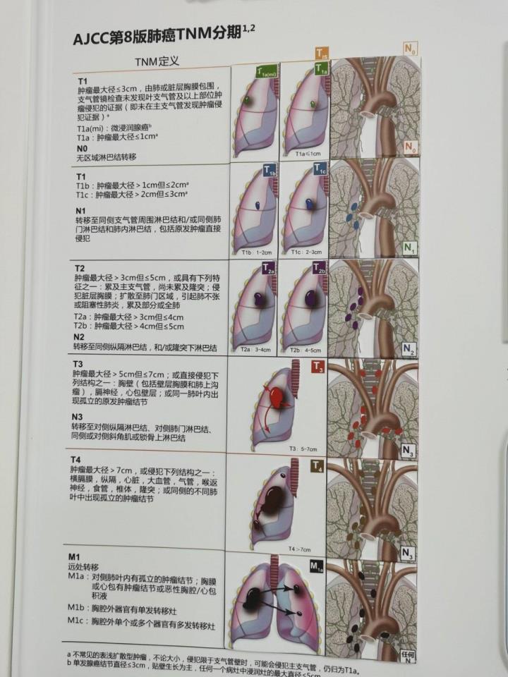 肺切除后能活多久(灭亡最快的肺癌是哪一种)