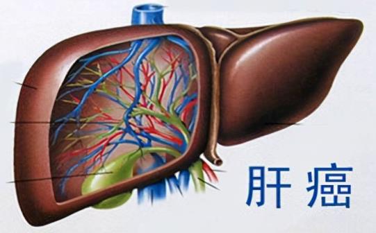 肝癌初期活多久(肝癌初期还能治吗)