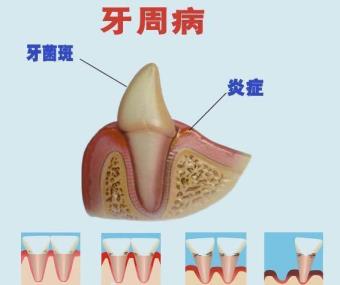 牙齿多久洗一次(普通人多久洗一次牙)