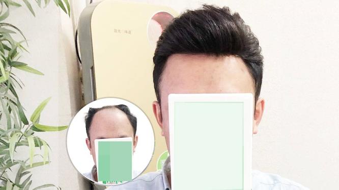 假发哪一个好(做假发最好的是哪一个品牌)